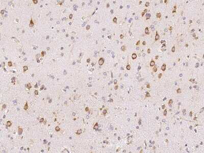 Immunohistochemistry-Paraffin: TTK Antibody [NBP2-98832]