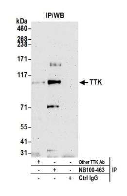 Immunoprecipitation: TTK Antibody [NB100-463]