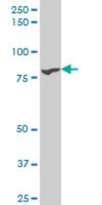 Western Blot: TTK Antibody (X1) [H00007272-M05]