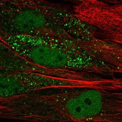 Immunocytochemistry/ Immunofluorescence: TTL Antibody [NBP2-57533]