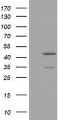 Western Blot: TTL Antibody (OTI3G5)Azide and BSA Free [NBP2-74668]