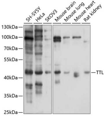 Western Blot: TTL AntibodyBSA Free [NBP2-95124]