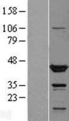 Western Blot: TTL Overexpression Lysate [NBL1-17416]