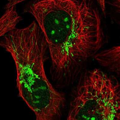 Immunocytochemistry/ Immunofluorescence: TTLL1 Antibody [NBP2-13491]