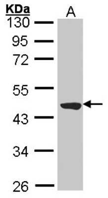 Western Blot: TTLL1 Antibody [NBP1-32805]