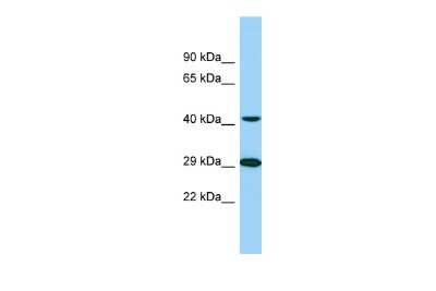 Western Blot: TTLL1 Antibody [NBP2-88513]