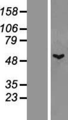 Western Blot: TTLL1 Overexpression Lysate [NBL1-17417]