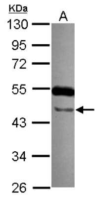 Western Blot: TTLL10 Antibody [NBP2-20755]