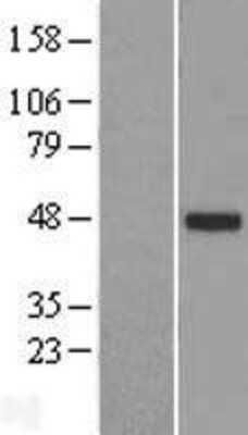 Western Blot: TTLL10 Overexpression Lysate [NBP2-05280]