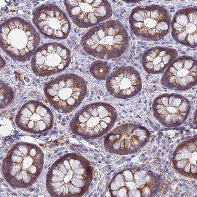 Immunohistochemistry-Paraffin: TTLL11 Antibody [NBP2-14495]