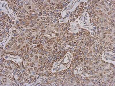 Immunohistochemistry-Paraffin: TTLL12 Antibody [NBP2-15149]