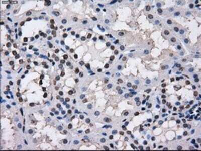 Immunohistochemistry: TTLL12 Antibody (OTI7F11) - Azide and BSA Free [NBP2-74676]