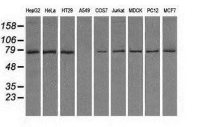 Western Blot: TTLL12 Antibody (OTI7F11) [NBP2-02216]