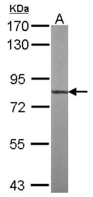 Western Blot: TTLL12 Antibody [NBP2-15149]