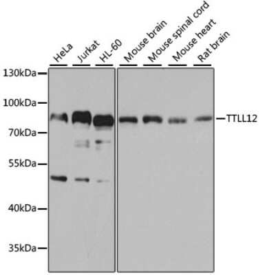 Western Blot: TTLL12 AntibodyBSA Free [NBP2-93988]