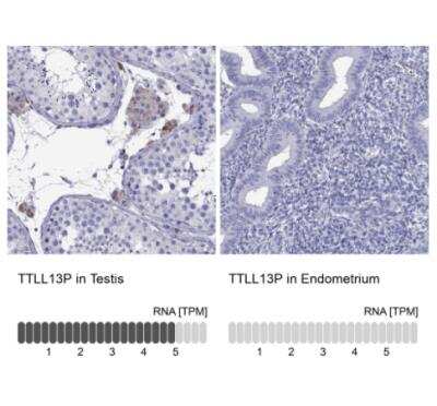 Immunohistochemistry-Paraffin: TTLL13 Antibody [NBP2-13492]