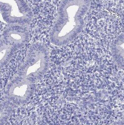 Immunohistochemistry-Paraffin: TTLL13 Antibody [NBP2-13492]