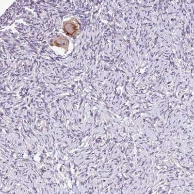 Immunohistochemistry-Paraffin: TTLL3 Antibody [NBP2-13493]