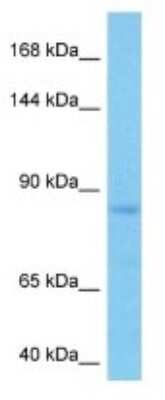 Western Blot: TTLL3 Antibody [NBP3-11014]