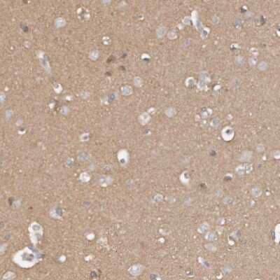 Immunohistochemistry-Paraffin: TTLL4 Antibody [NBP1-81535]
