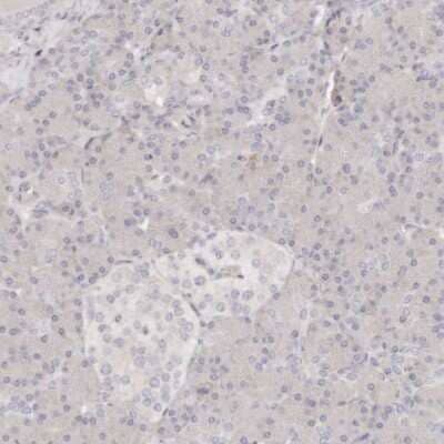 Immunohistochemistry-Paraffin: TTLL4 Antibody [NBP1-81535]