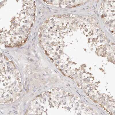 Immunohistochemistry-Paraffin: TTLL4 Antibody [NBP1-81535]