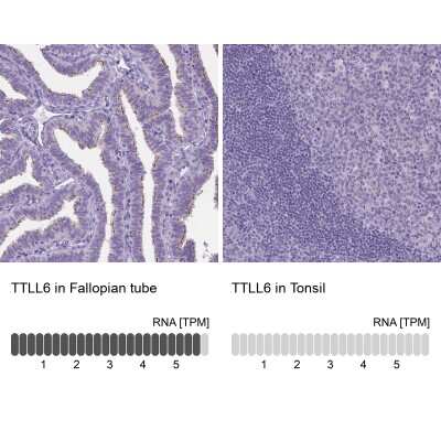 Immunohistochemistry-Paraffin: TTLL6 Antibody [NBP2-49041]