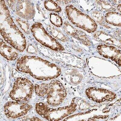 Immunohistochemistry-Paraffin: TTLL8 Antibody [NBP1-91090]