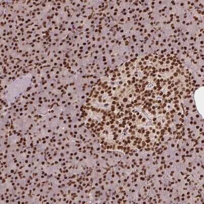 Immunohistochemistry: TTLL9 Antibody [NBP2-38765]