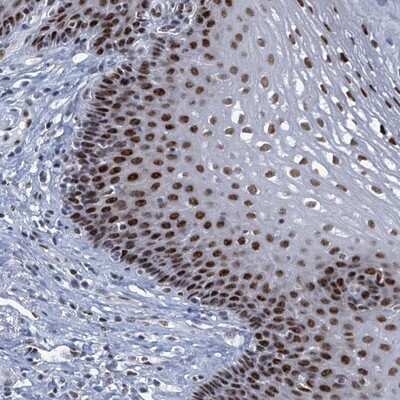 Immunohistochemistry-Paraffin: TTLL9 Antibody [NBP1-92543]