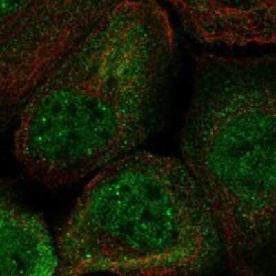 Immunocytochemistry/ Immunofluorescence: TTMP Antibody [NBP3-17452]