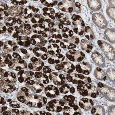 Immunohistochemistry-Paraffin: TTMP Antibody [NBP1-93935]