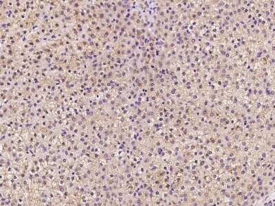 Immunohistochemistry: TTMP Antibody [NBP2-97345]