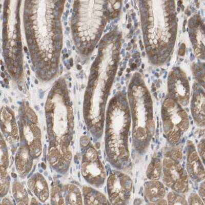 Immunohistochemistry-Paraffin: TTMP Antibody [NBP1-93934]