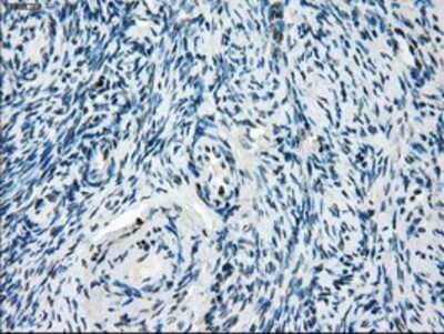 Immunohistochemistry-Paraffin: TTP Antibody (OTI8B5) [NBP2-02105]