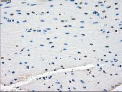 Immunohistochemistry: TTP Antibody (OTI8B5) - Azide and BSA Free [NBP2-74681]