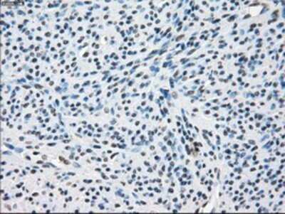Immunohistochemistry: TTP Antibody (OTI8B5) - Azide and BSA Free [NBP2-74681]