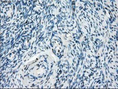Immunohistochemistry: TTP Antibody (OTI8B5) - Azide and BSA Free [NBP2-74681]
