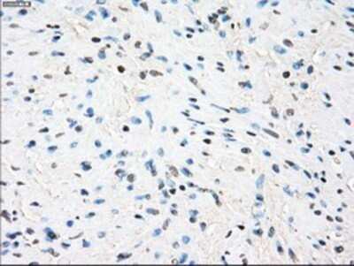 Immunohistochemistry: TTP Antibody (OTI8B5) - Azide and BSA Free [NBP2-74681]