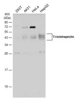 Western Blot: TTP Antibody [NBP3-12978]