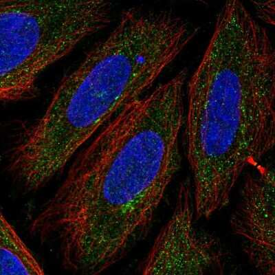 Immunocytochemistry/ Immunofluorescence: TTPAL Antibody [NBP2-56602]