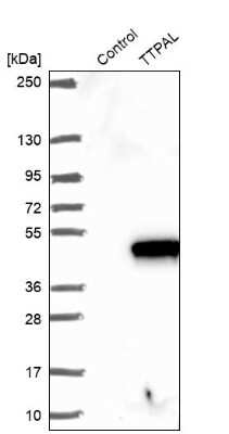 Western Blot: TTPAL Antibody [NBP1-92544]