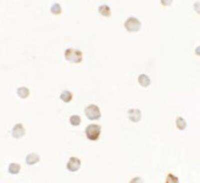 Immunocytochemistry/ Immunofluorescence: TTYH1 Antibody - BSA Free [NBP2-81944]