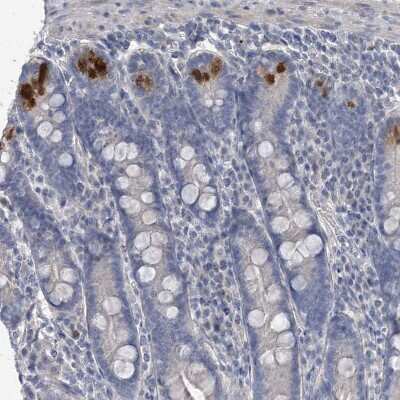 Immunohistochemistry-Paraffin: TTYH1 Antibody [NBP1-85992]
