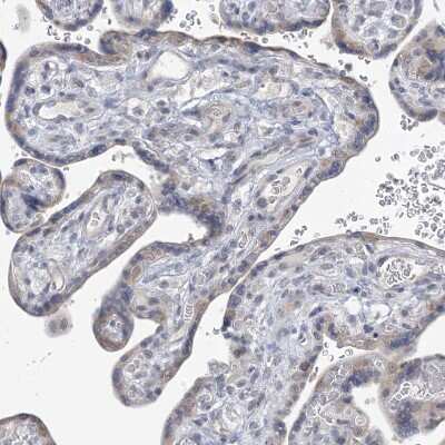 Immunohistochemistry-Paraffin: TTYH1 Antibody [NBP1-85992]