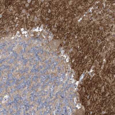 Immunohistochemistry-Paraffin: TTYH1 Antibody [NBP1-85992]