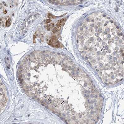 Immunohistochemistry-Paraffin: TTYH1 Antibody [NBP1-85992]