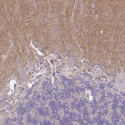 Immunohistochemistry-Paraffin: TTYH1 Antibody [NBP2-38634]