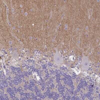 Immunohistochemistry-Paraffin: TTYH1 Antibody [NBP2-38634]
