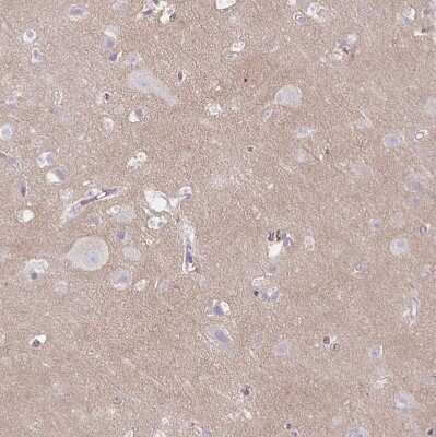 Immunohistochemistry-Paraffin: TTYH1 Antibody [NBP2-38634]